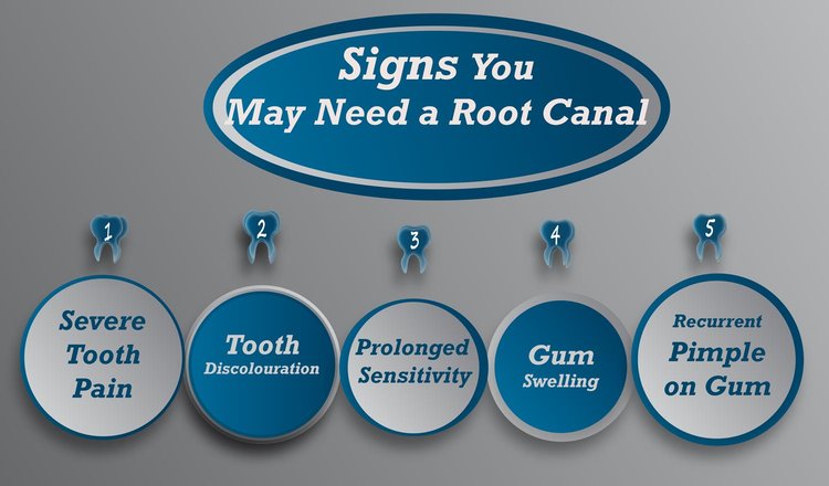 signs-of-root-canal.jpg